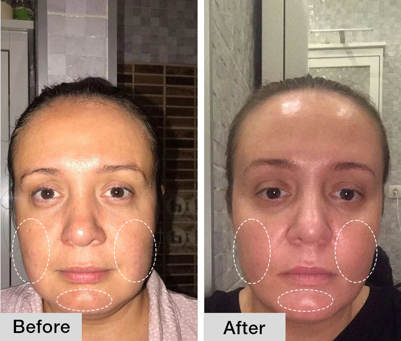 Nuvio Pro Rejuvenator