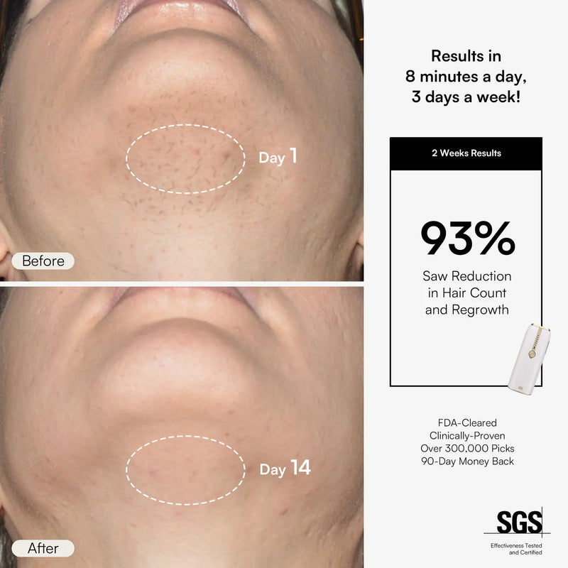 Nuvio IPL-Haarentfernungsgerät