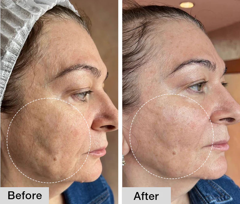 Nuvio Pro Rejuvenator