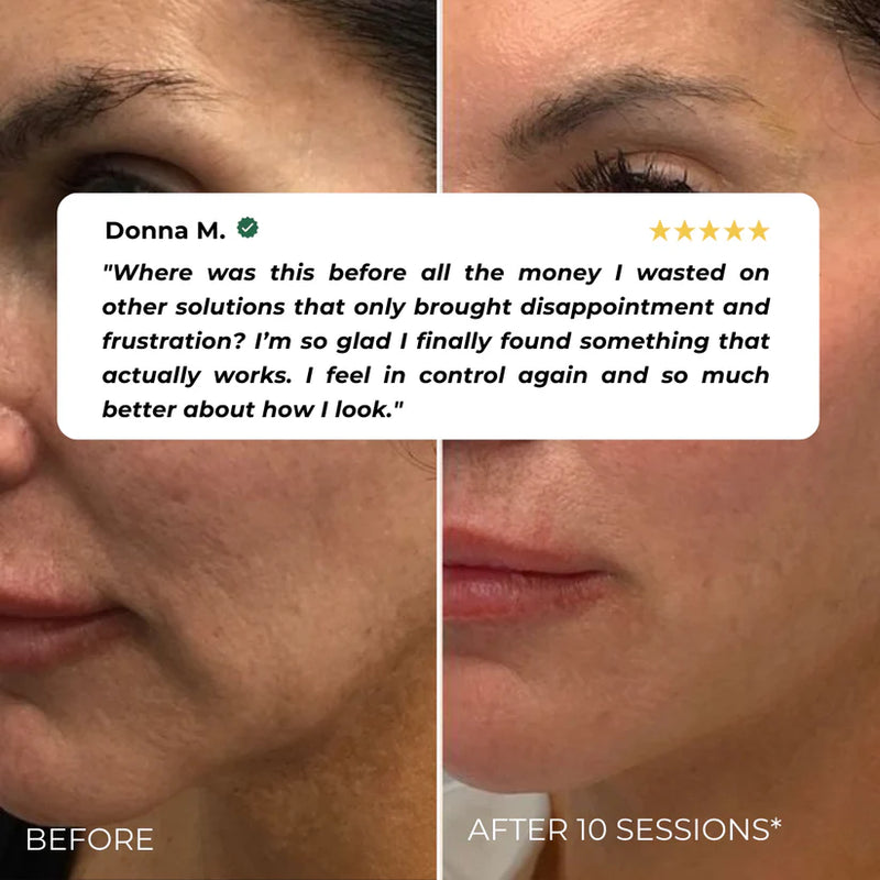 Nuvio EMS Eye Lift Patch