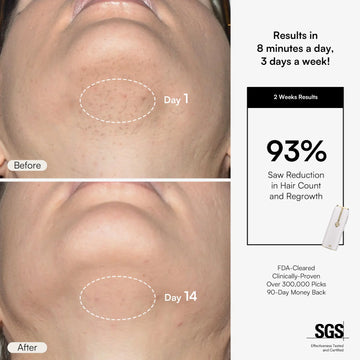 Nuvio IPL-Haarentfernungsgerät