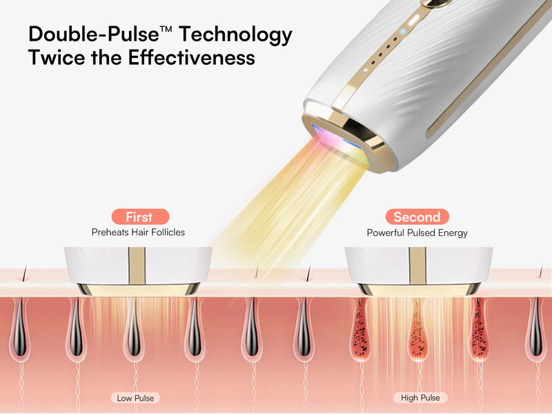 Nuvio IPL-Haarentfernungsgerät